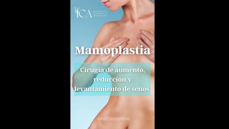 Mamoplastia - ICA, Instituto de Cirugía Avanzada