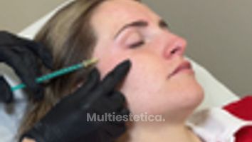 Eliminación y prevención de arrugas - Clínica Opción Médica