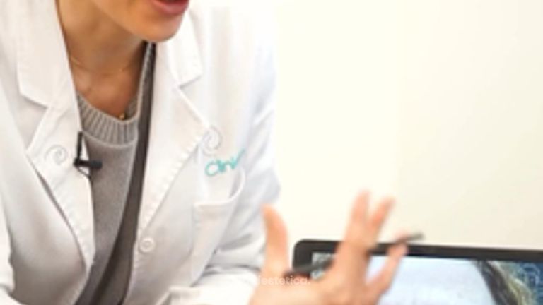 Blefaroplastia - Cliniem