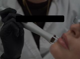 Preguntas rápidas sobre el Láser CO2