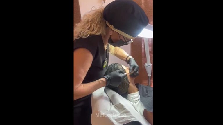 Rejuvenecimiento facial - Clínicas Dra. Matas