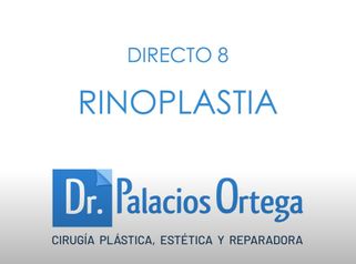 DIRECTO rinoplastia (II)