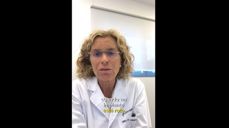 Recambio de implantes - Dra. Dolça López Munne