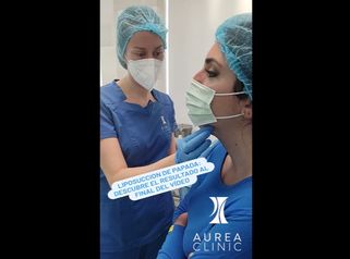 Liposucción de papada - Dra. Ana Martinez Padilla