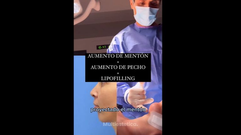 Aumento de mentón - Clínica Dr. Jiménez