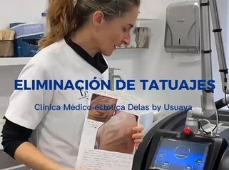 Clínica Delas - Eliminacion de tatuajes