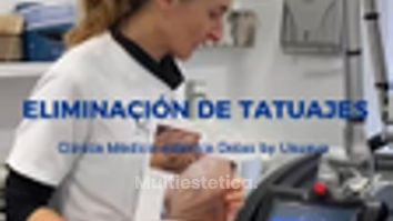 Clínica Delas - Eliminacion de tatuajes