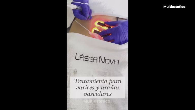 Clínica Lasernova - Varices