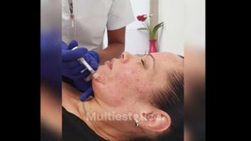 Skinbooster - Clínica Vecindario
