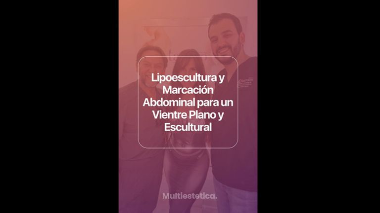Lipoescultura - Clínica Tarrazo