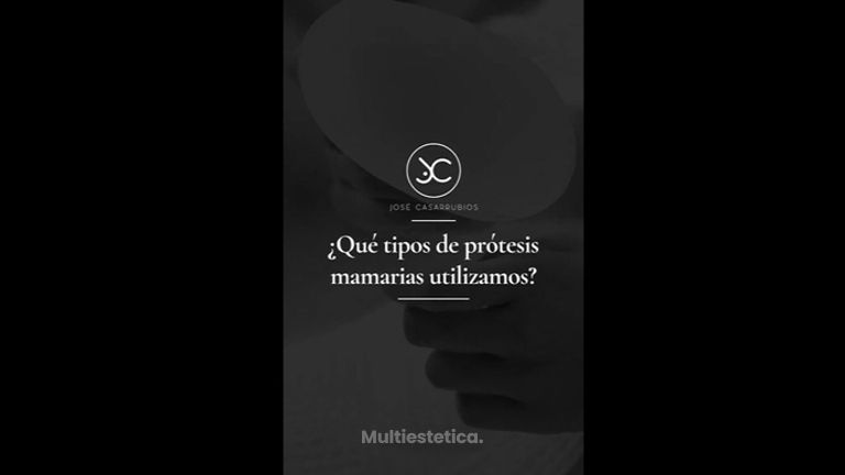 Tipos de prótesis - Dr. Jose Casarrubios