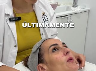 La rosácea es una condición de la piel que se nota por la rojez constante,