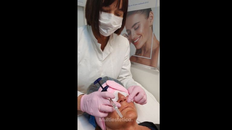 Rejuvenecimiento facial - Clinica Renobell