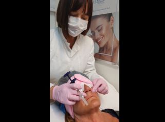Rejuvenecimiento facial - Clinica Renobell