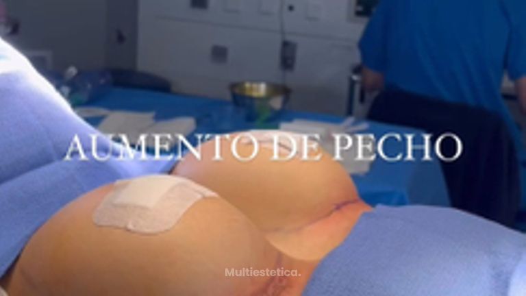 Aumento de pecho - Clínica Dr. Jiménez