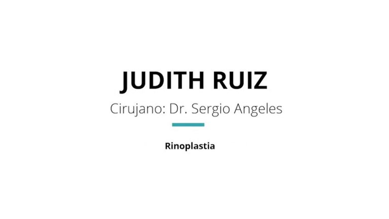 Testimonio de Rinoplastia