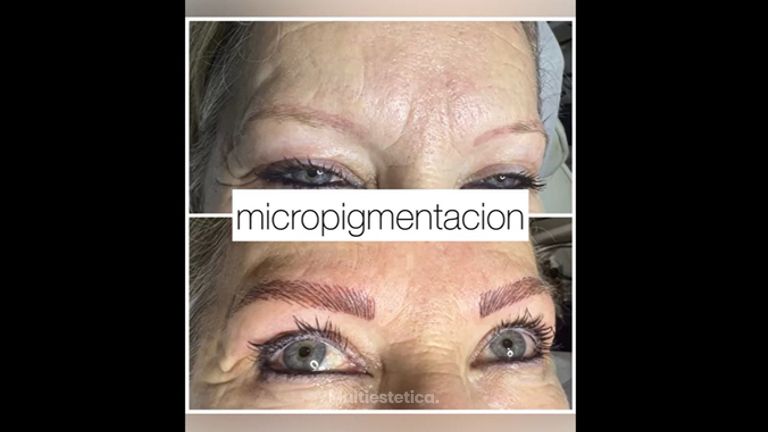 Micropigmentación - Centro Ana Jurado