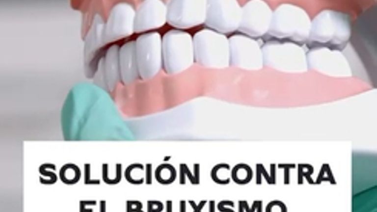 Bruxismo - Clínica de la Cuesta CDC