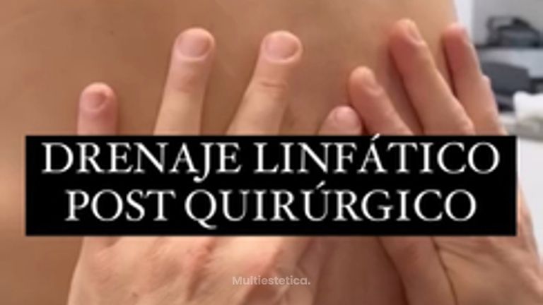 Drenaje linfático - Clínica Dr. Jiménez