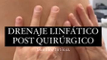 Drenaje linfático - Clínica Dr. Jiménez