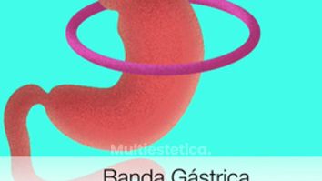 Técnicas Bariatricas