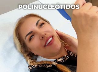 Polinucleótidos - Clínica Opción Médica