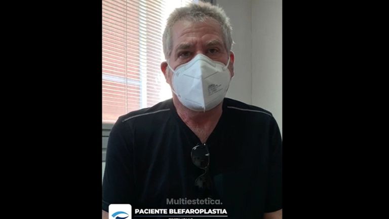 Testimonio Blefaroplastia - Dr. Jiménez Ortiz