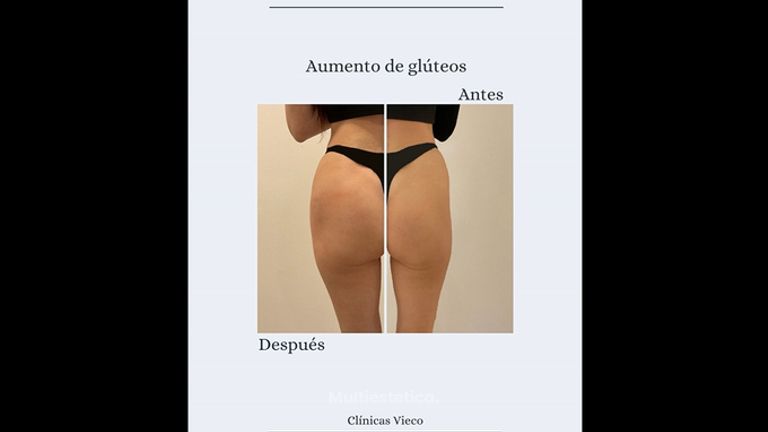 Clínicas Vieco