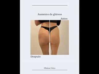 Clínicas Vieco