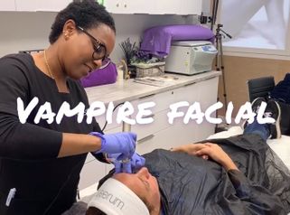 Vampire facial - Clínica Dra Rigo