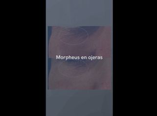 Morpheus en ojeras - Dr. Jiménez Ortiz