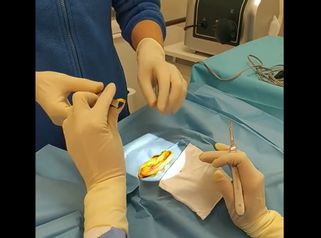 Otoplastia - Dra. Ana Martinez Padilla