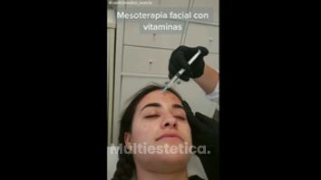 Mesoterapia - Centro Médico Primo De Rivera