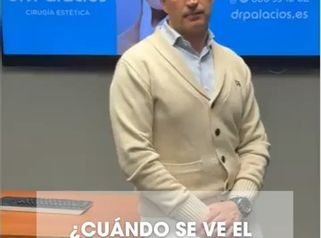 Rinoplastia: cuándo se ve el resultado definitivo