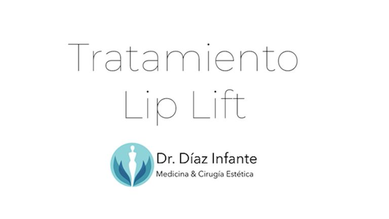 Lip Lift - Dr. José Luis Díaz Infante