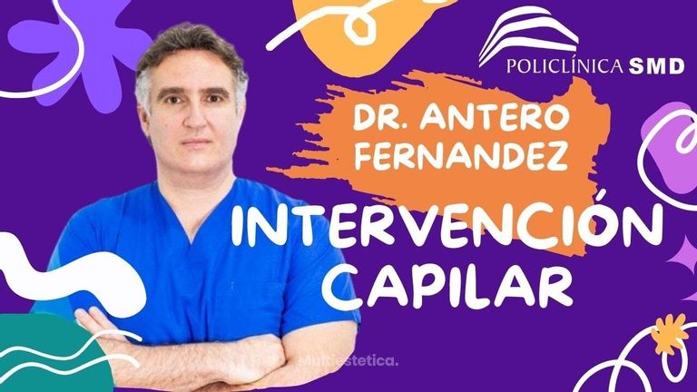 Como realizamos la intervencion de implante capilar con KEEP, lo explica el DR Antero Fernadez.