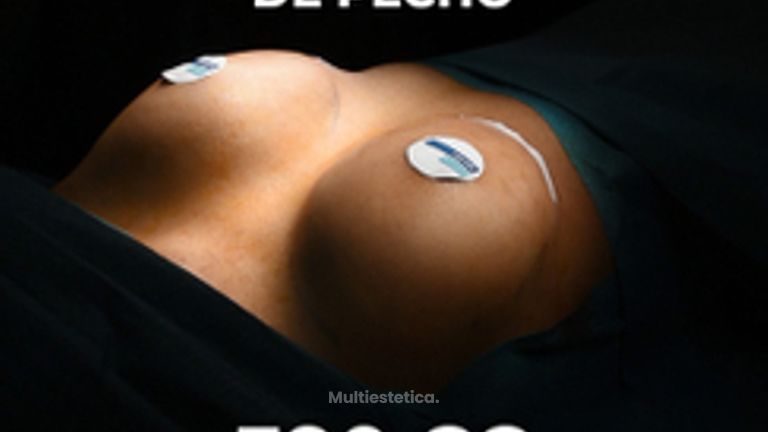 Aumento de pecho - Clínica Opción Médica