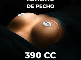 Aumento de pecho - Clínica Opción Médica
