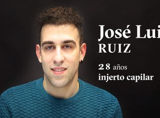 Injerto Capilar: José Luis nos cuenta su experiencia