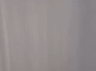 Depilación Laser - Medicina Estética Coimbra