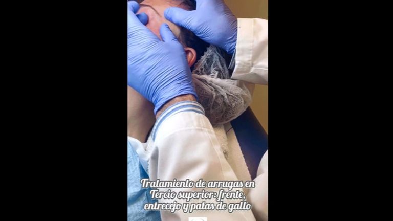 Rellenos faciales - Centro Médico Primo De Rivera