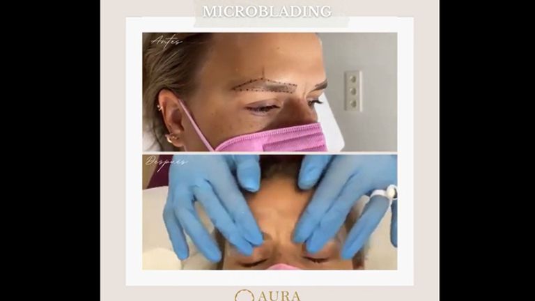 Microblading - Aura Clínica