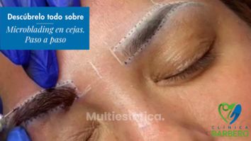 Microblading - Clínica Barbero