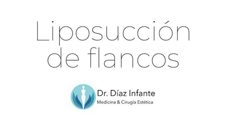 Liposucción de flancos - Dr. José Luis Díaz Infante