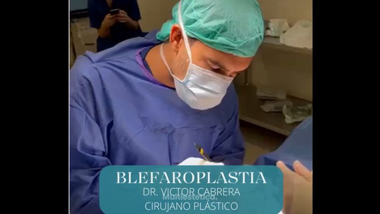Blefaroplastia - Clínica Rinos