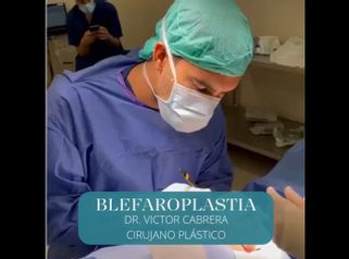 Blefaroplastia - Clínica Rinos