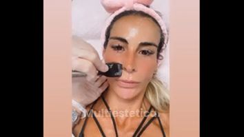 Radiofrecuencia facial - Dra. Marta García Redondo