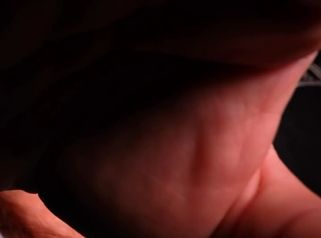 Tecnología 3D y máxima precisión en rinoplastia ultrasónica