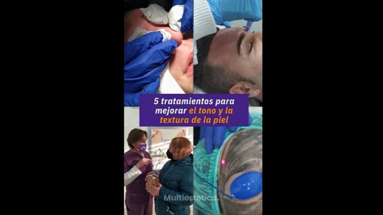 Rejuvenecimiento facial - Clínica Tarrazo