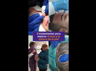 Rejuvenecimiento facial - Clínica Tarrazo